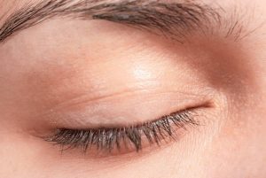 Swollen Eyelid Treatment chicago