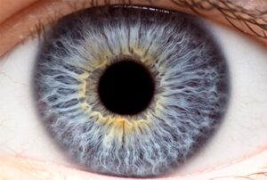 cornea misshapen cornea misshapen