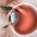 Diabetic Retinopathy treatment Hoffman Estates