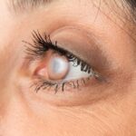 Cataract surgery in Hoffman Estates, IL